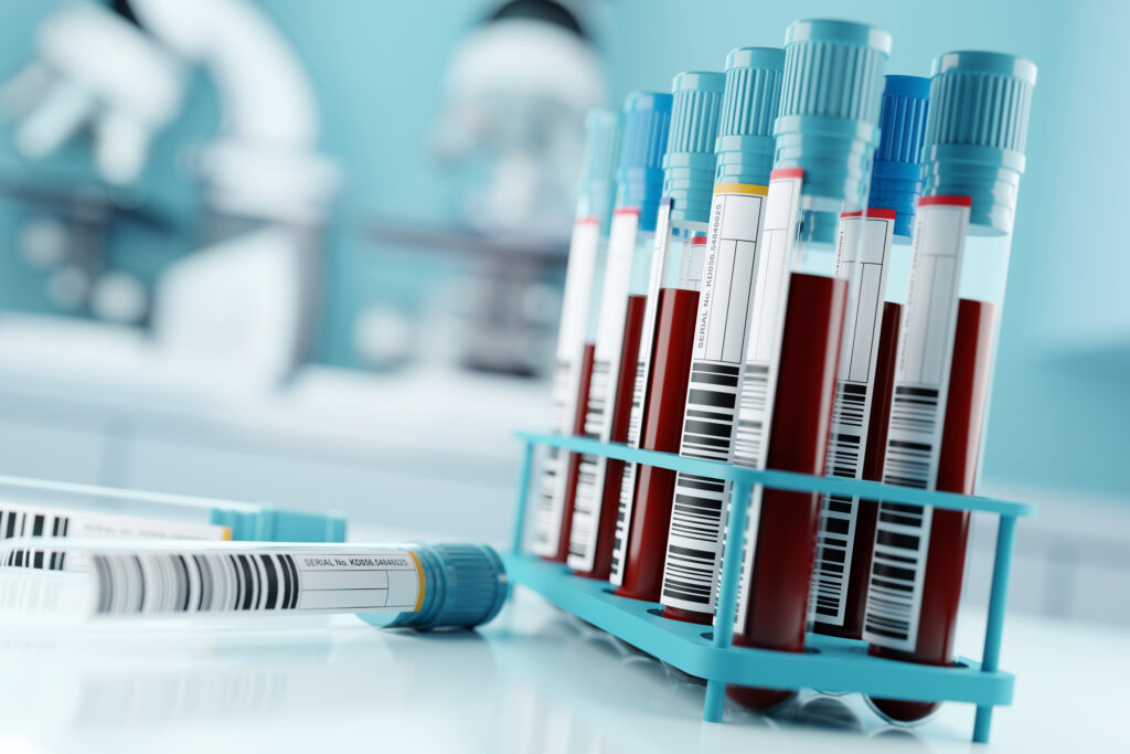 Guilty Plea: Lab Owner Falsified COVID-19 Test Results During Pandemic Guilty Plea: Lab Owner Falsified COVID-19 Test Results During Pandemic